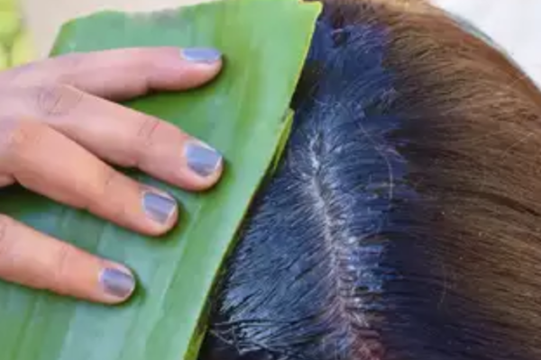 Aloe Vera to Prevent Hair Loss and Itch