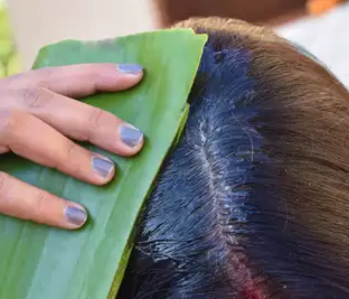 Aloe Vera to Prevent Hair Loss and Itch