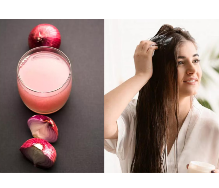 Castor Oil and Onion Juice for Hair: A Powerful Natural Remedy