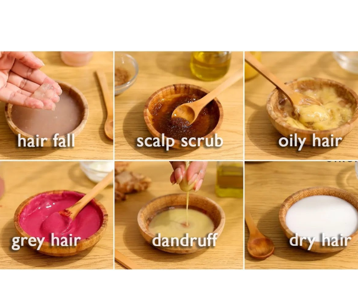 4 A Homemade Hair Mask for Dandruff: Natural Remedies for a Flake-Free Scalp