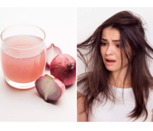 Best Home Remedies for Onion Juice to Gray Hair