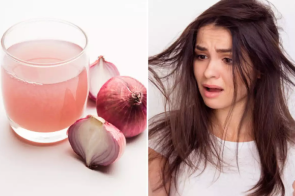 Best Home Remedies for Onion Juice to Gray Hair