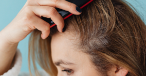 Woman applying scalp lotion for dry scalp to relieve itching and dryness