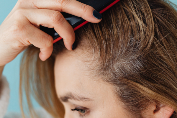 Woman applying scalp lotion for dry scalp to relieve itching and dryness