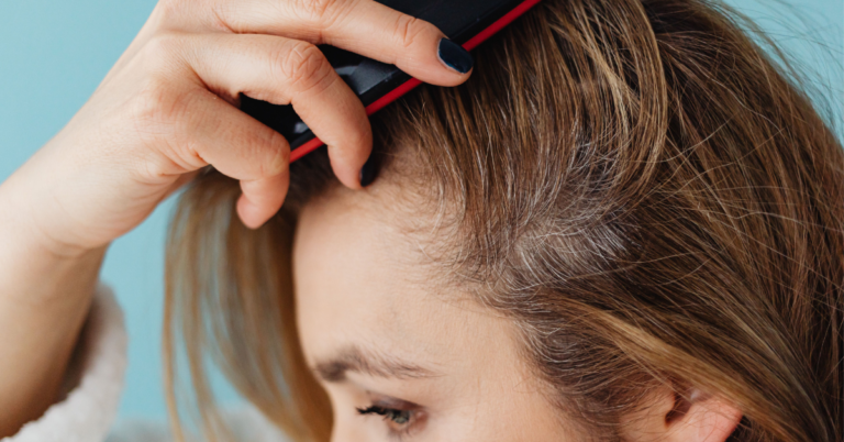 Scalp Lotion for Dry Scalp: Benefits, How to Use & Honest Review